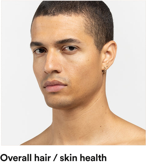 Concern - Overall Hair / Skin Health